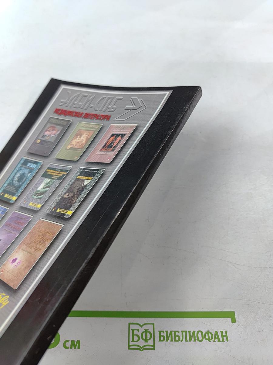 Рассеянный склероз