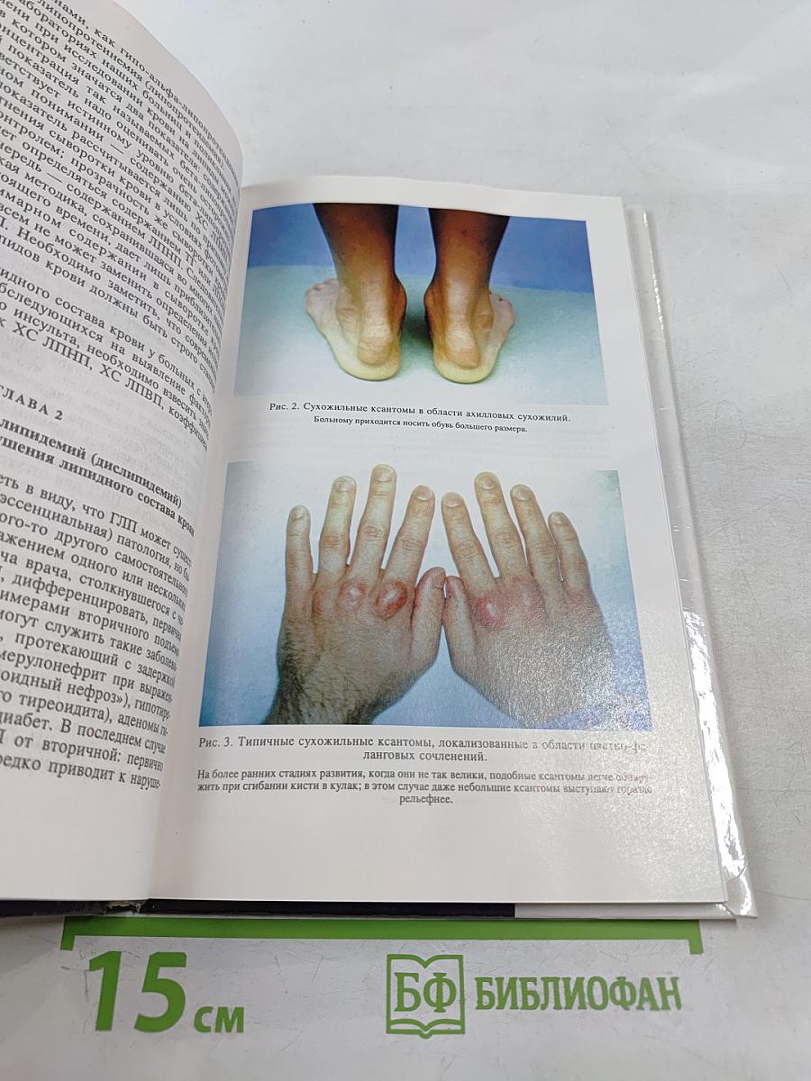 Клиническая липидология