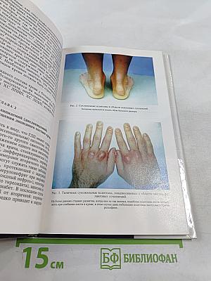 Клиническая липидология