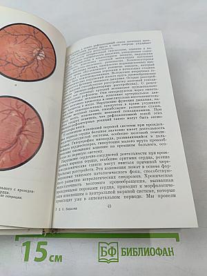 Неврологические синдромы при болезнях сердца