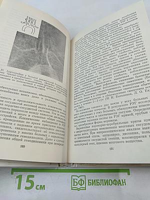 Неврологические синдромы при болезнях сердца