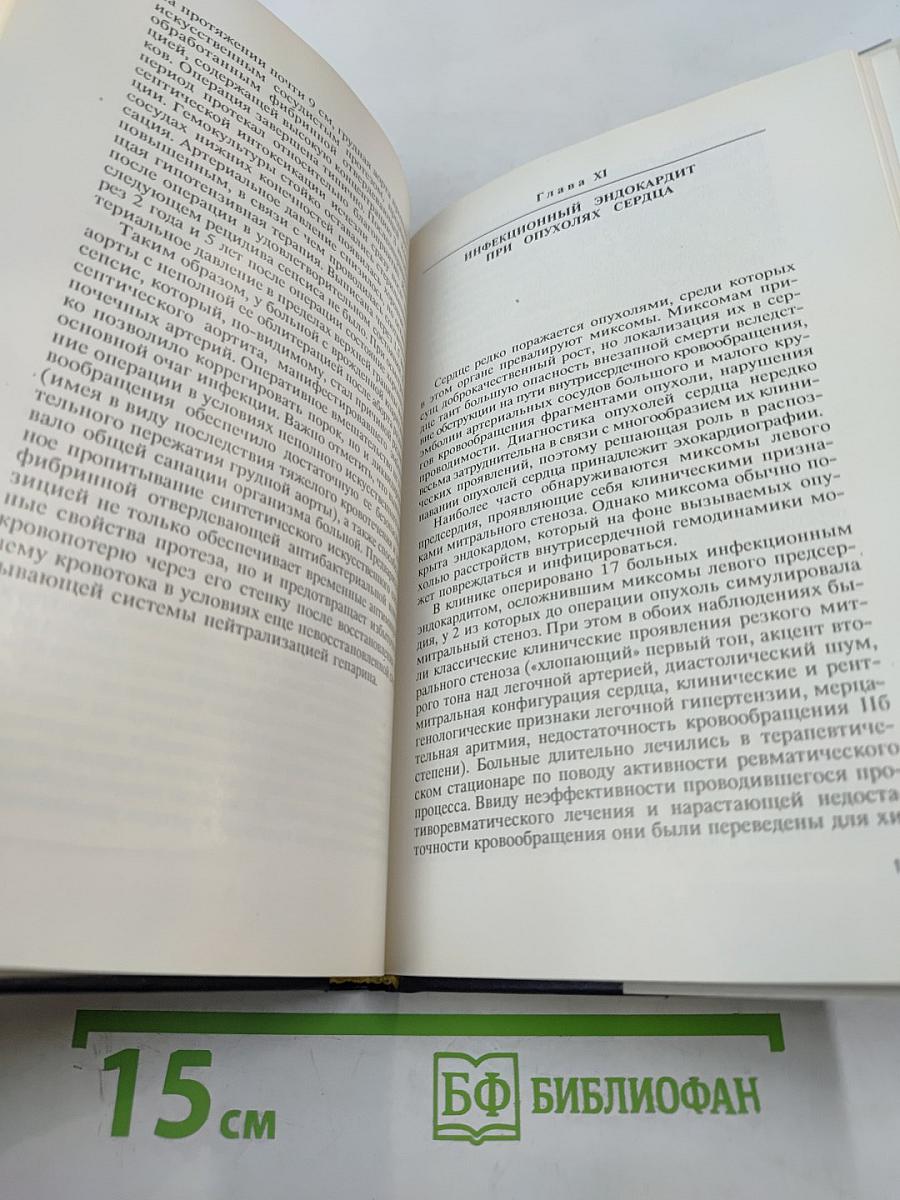 Хирургическое лечение инфекционного эндокардита