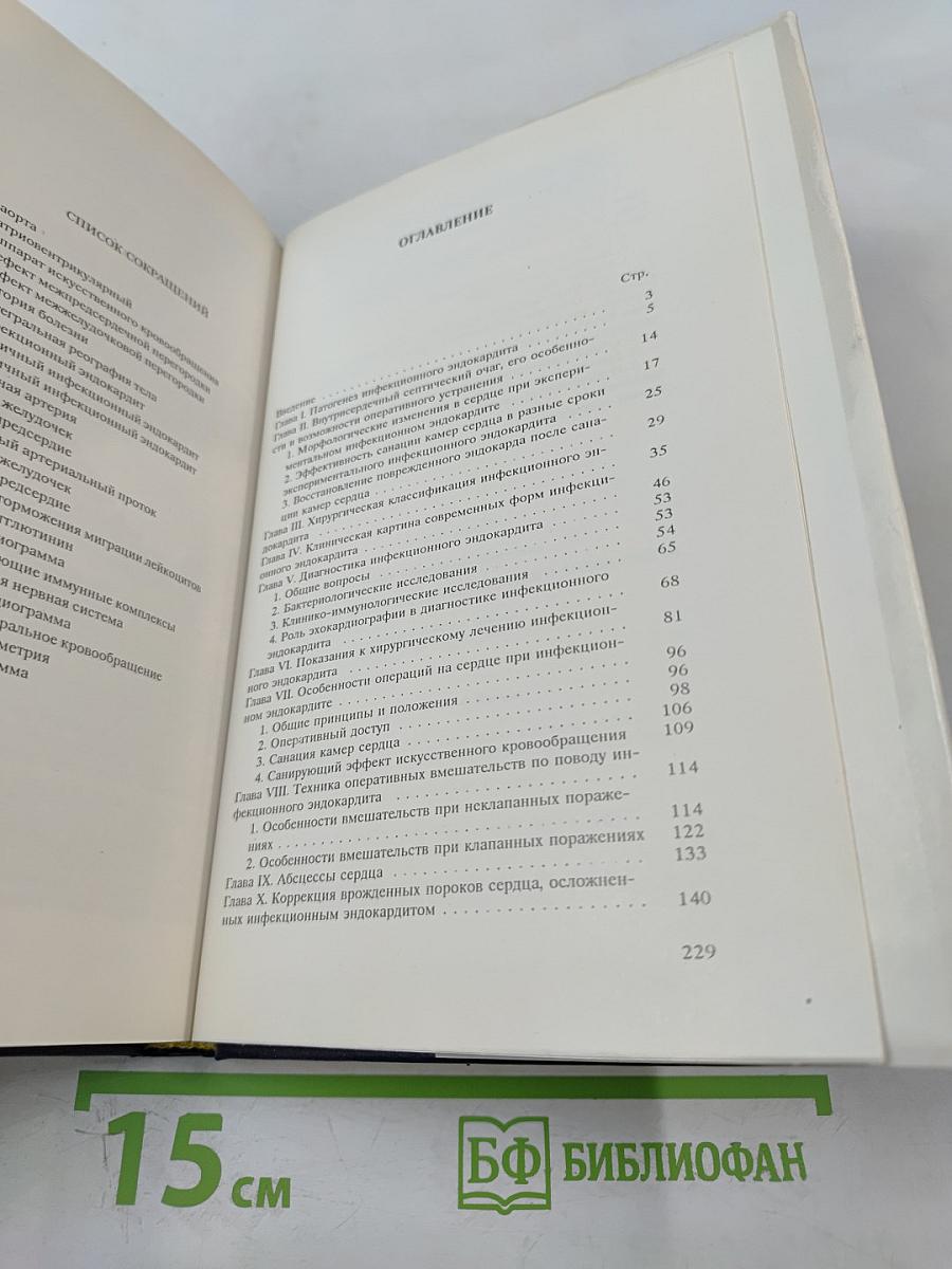 Хирургическое лечение инфекционного эндокардита