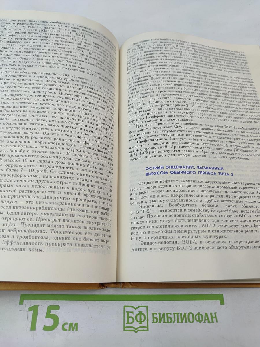 Острые нейроинфекции у детей