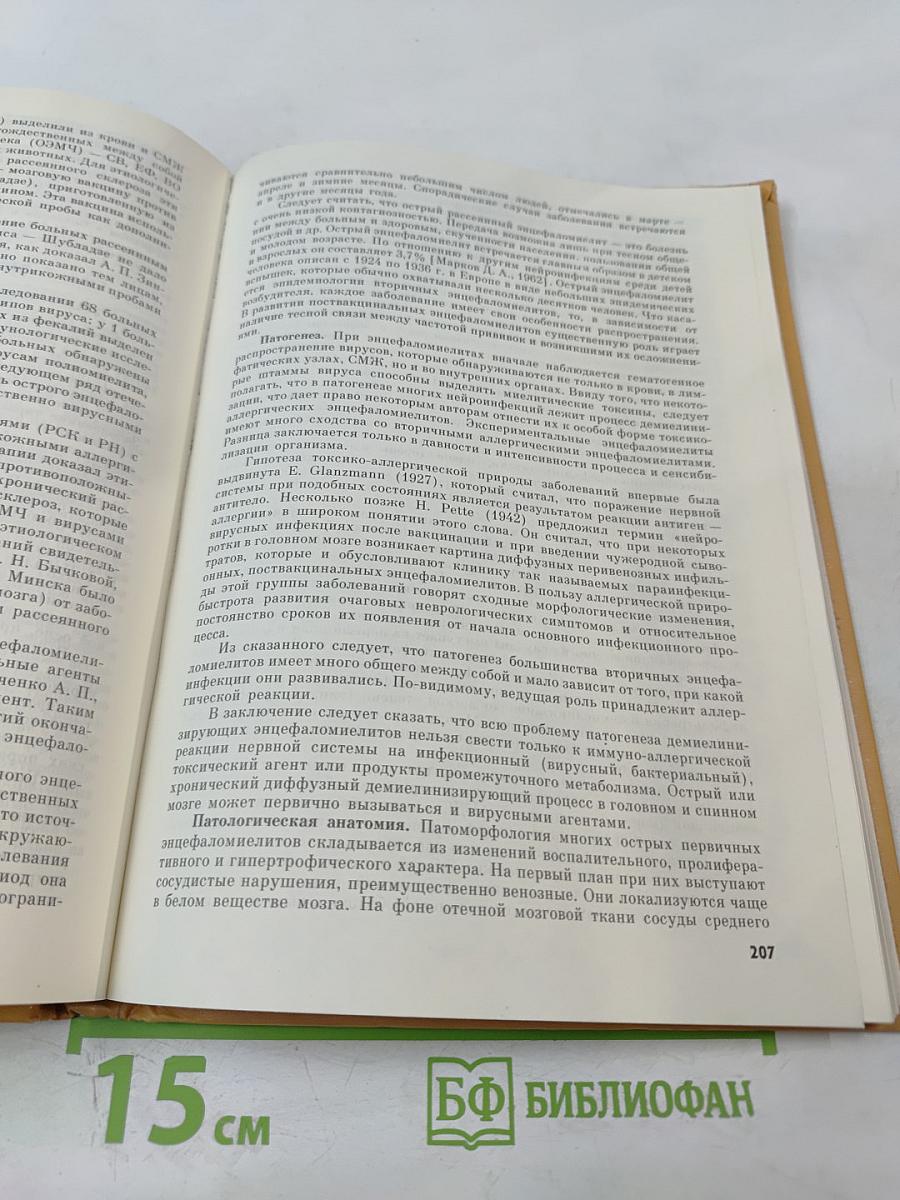 Острые нейроинфекции у детей