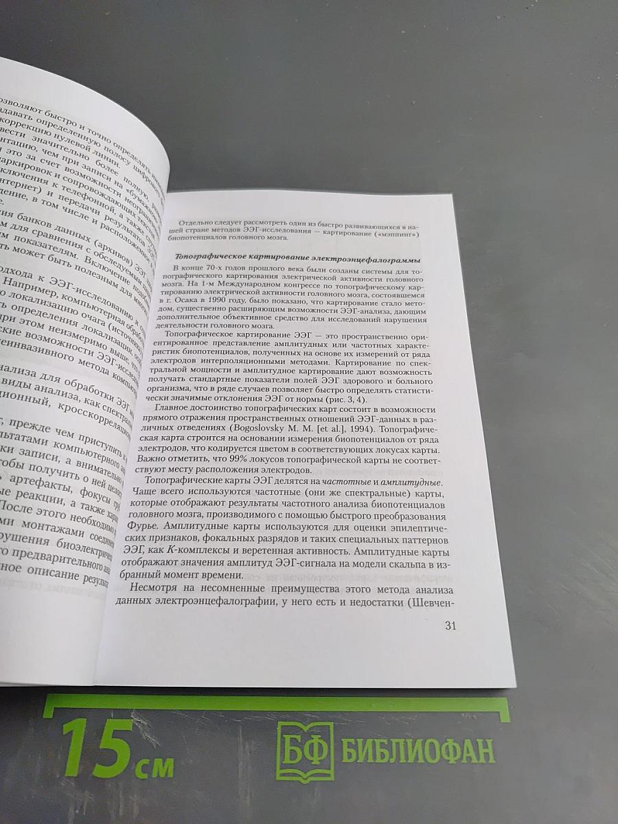 Электроэнцефалография