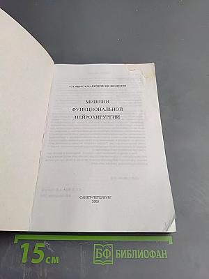 Мишени функциональной нейрохирургии