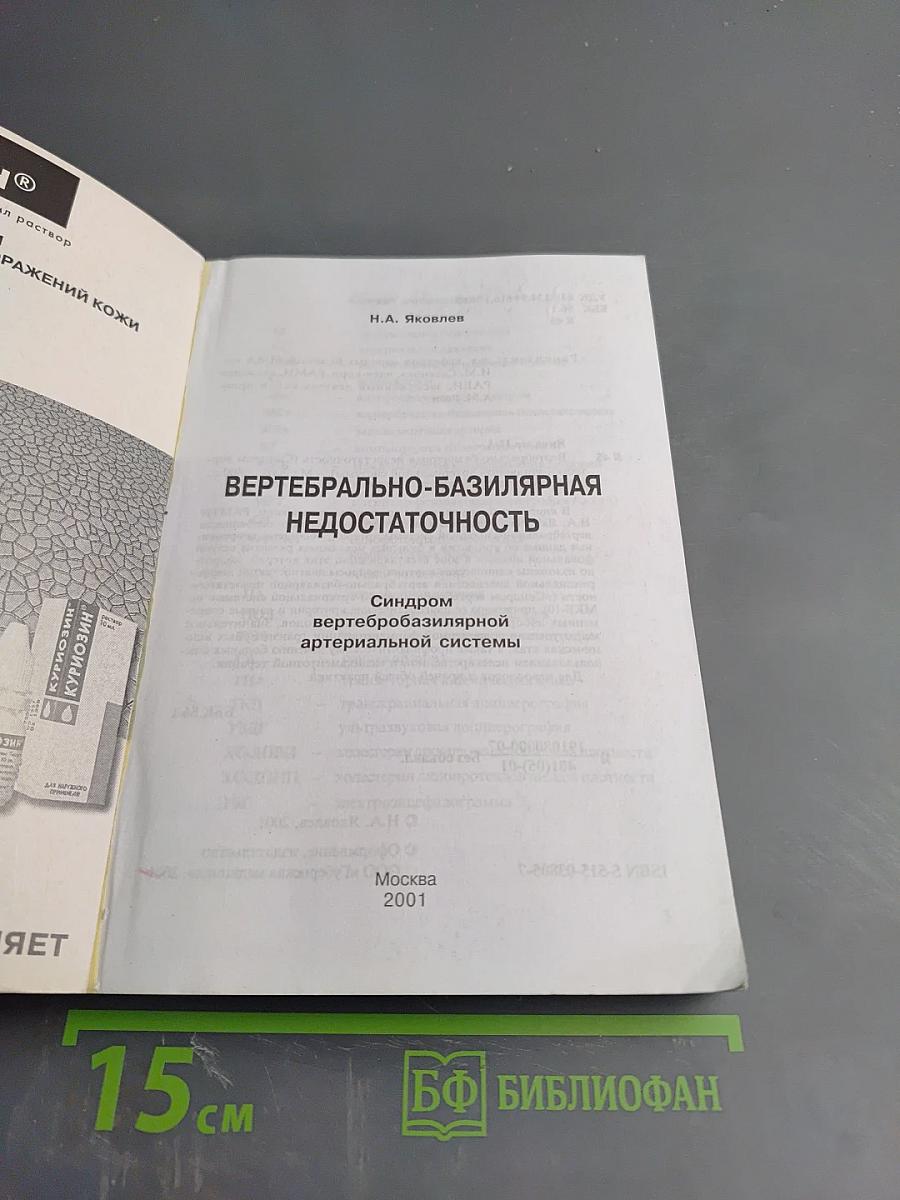 Вертебрально-базилярная недостаточность. Синдром вертебробазилярной артериальной системы