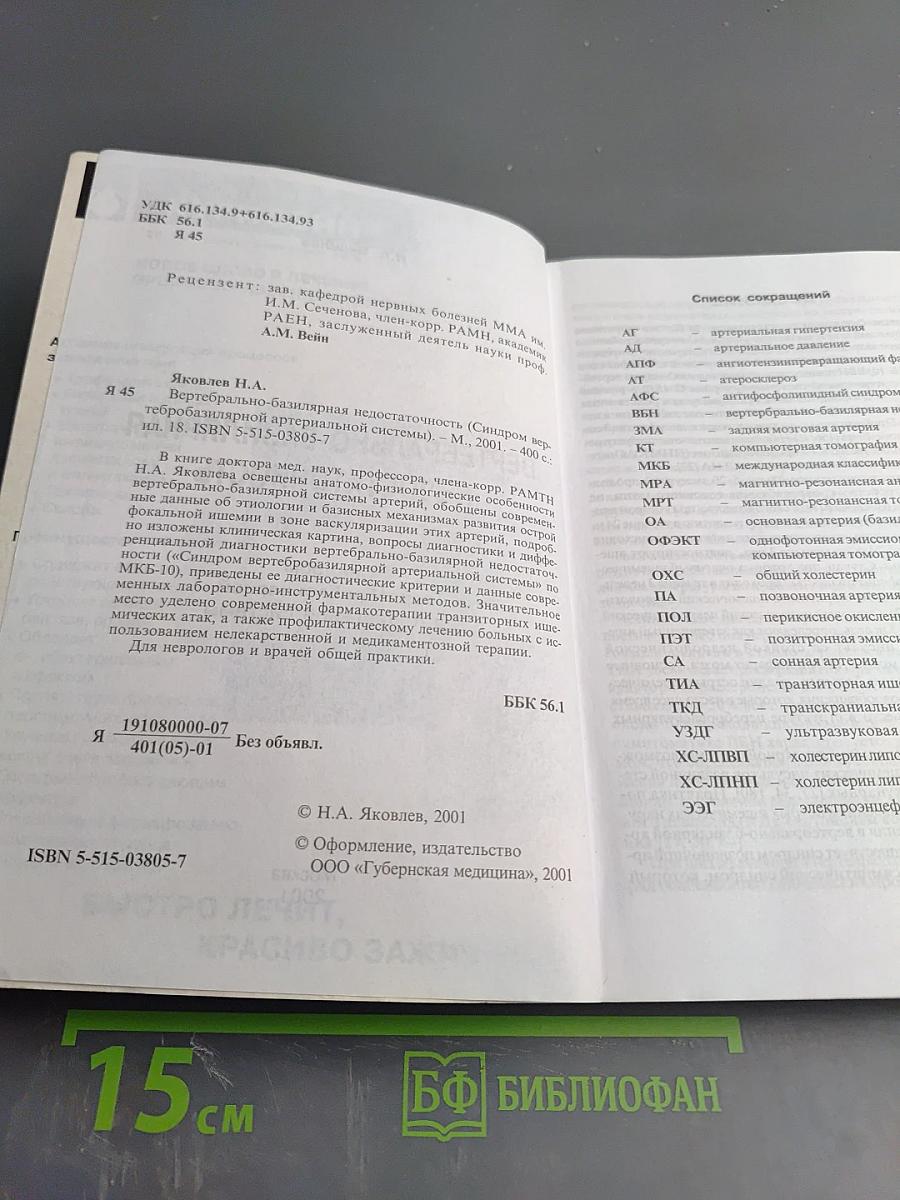 Вертебрально-базилярная недостаточность. Синдром вертебробазилярной артериальной системы