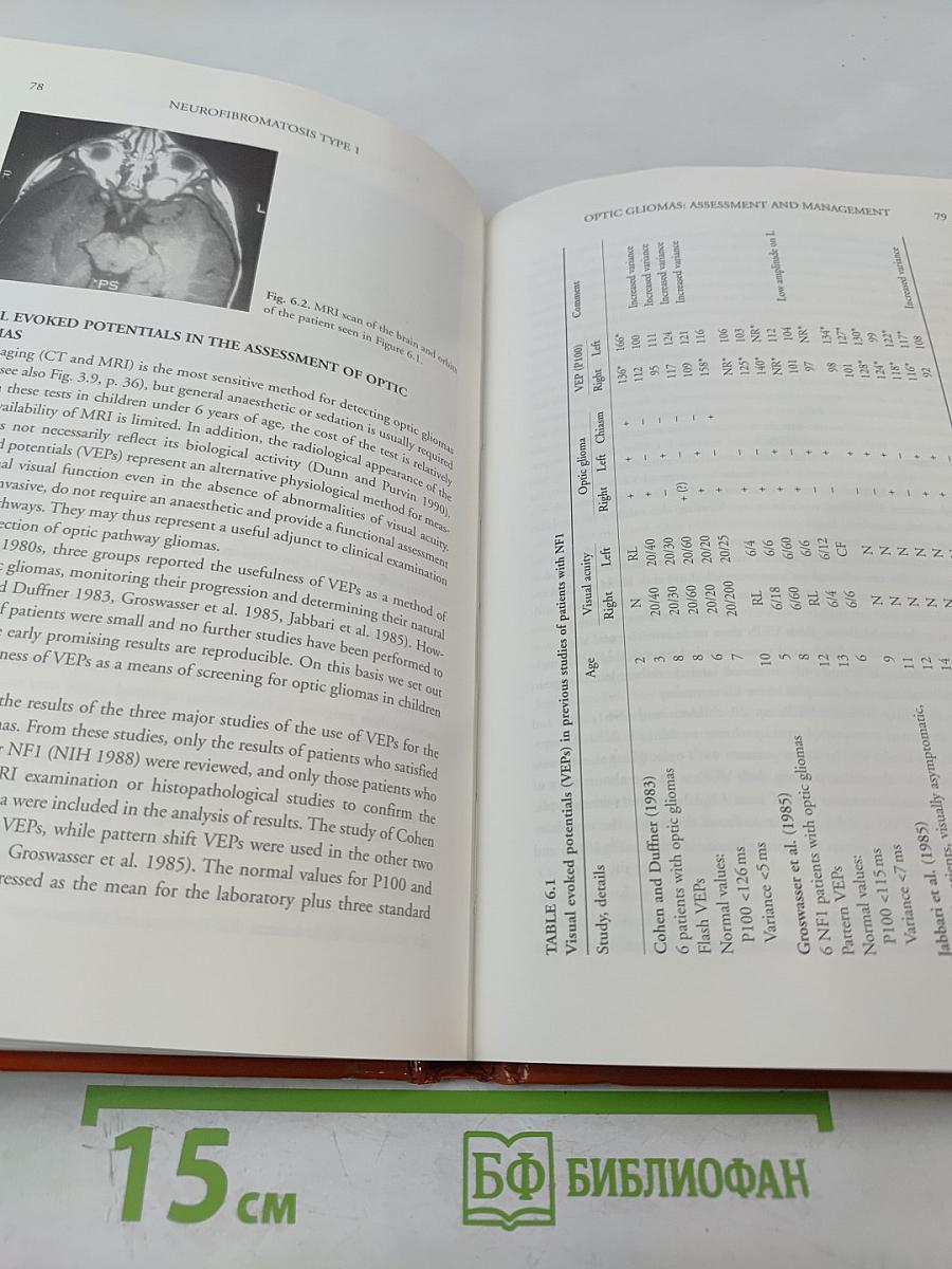 Neurofibromatosis Type 1 in Childhood