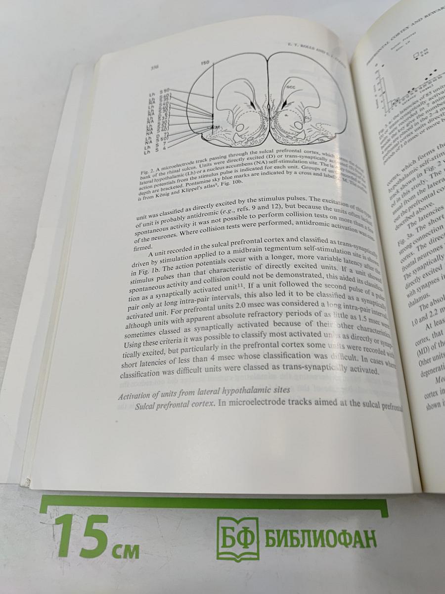 Brain Research. International Multidisciplinary Journal Devoted to Fundamental Research in the Brain Sciences. Vol. 60 No. 2