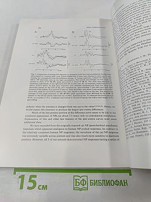Brain Research. International Multidisciplinary Journal Devoted to Fundamental Research in the Brain Sciences. Vol. 60 No. 2