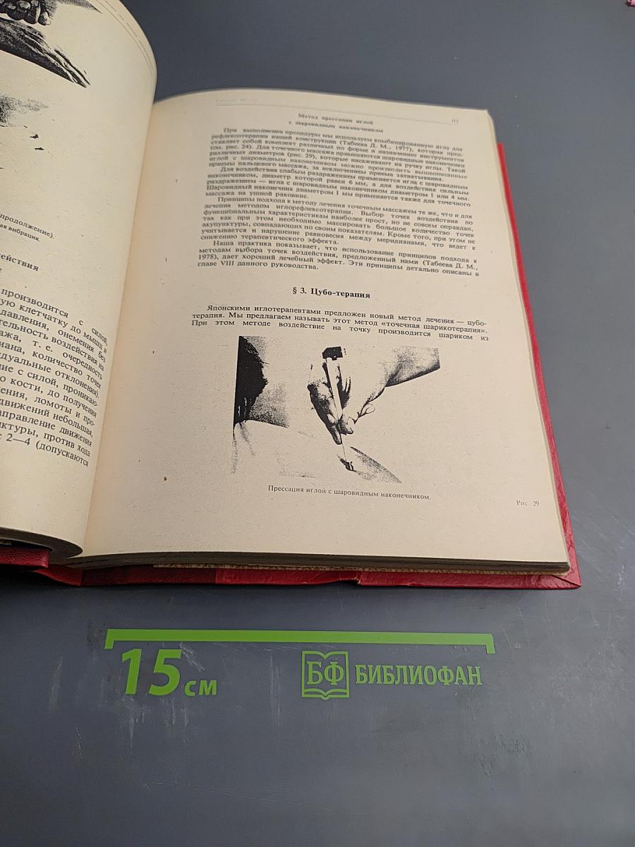 Руководство по иглорефлексотерапии