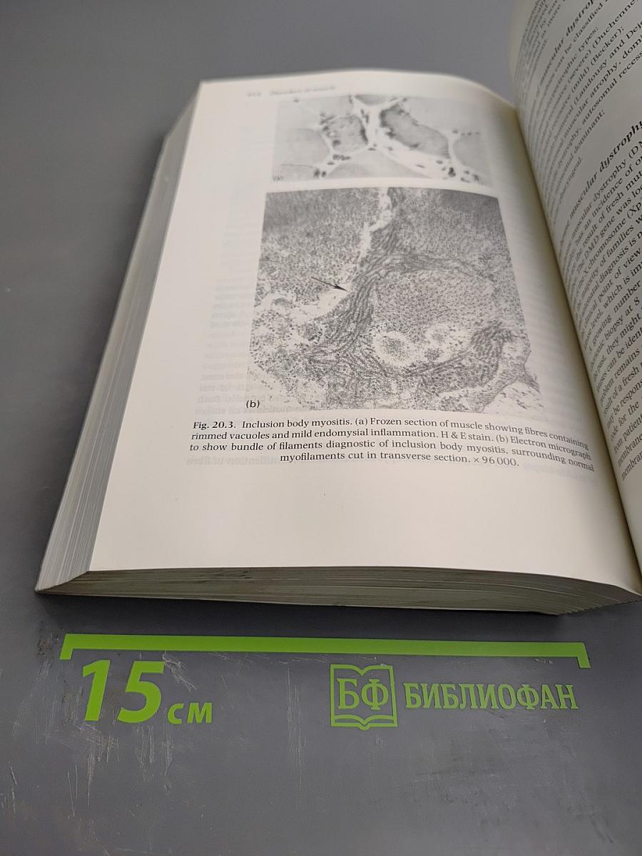 Brain and Bannister's Clinical Neurology, Seventh Edition