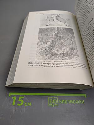 Brain and Bannister's Clinical Neurology, Seventh Edition