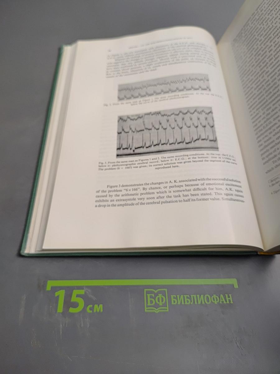 On the Electroencephalogram of Man