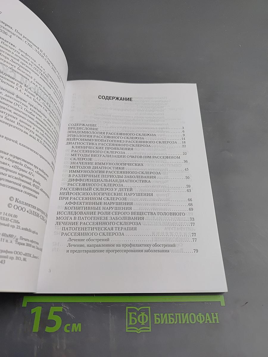 Рассеянный склероз