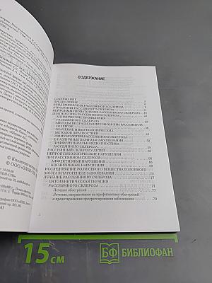 Рассеянный склероз