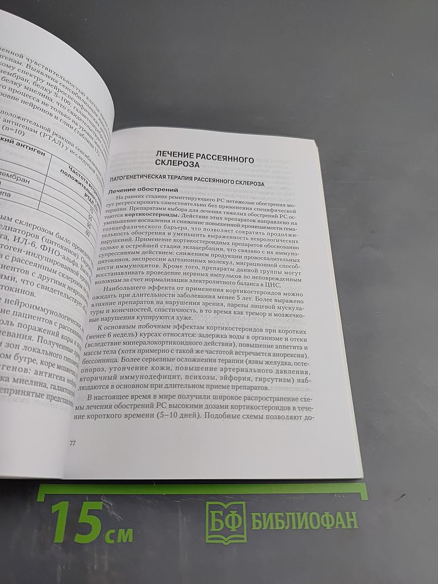 Рассеянный склероз