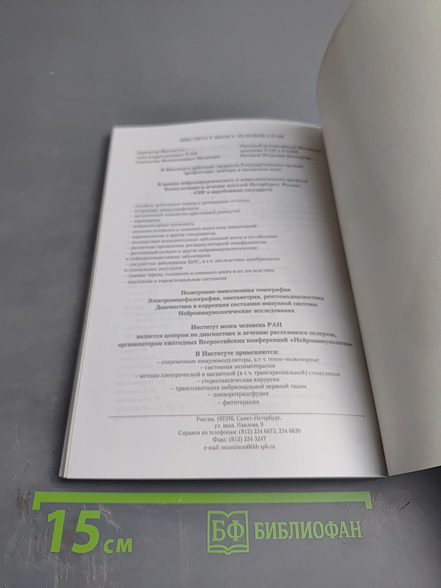 Рассеянный склероз