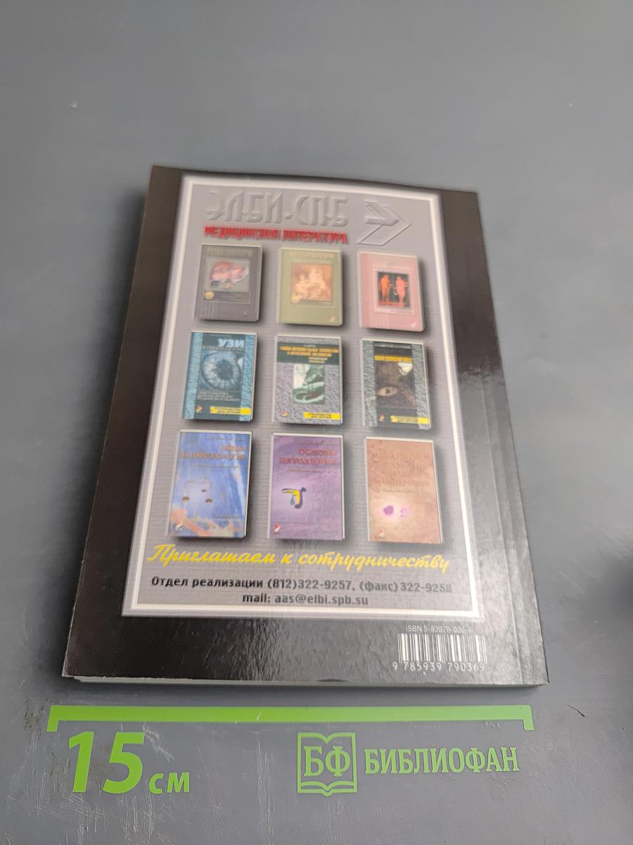 Рассеянный склероз