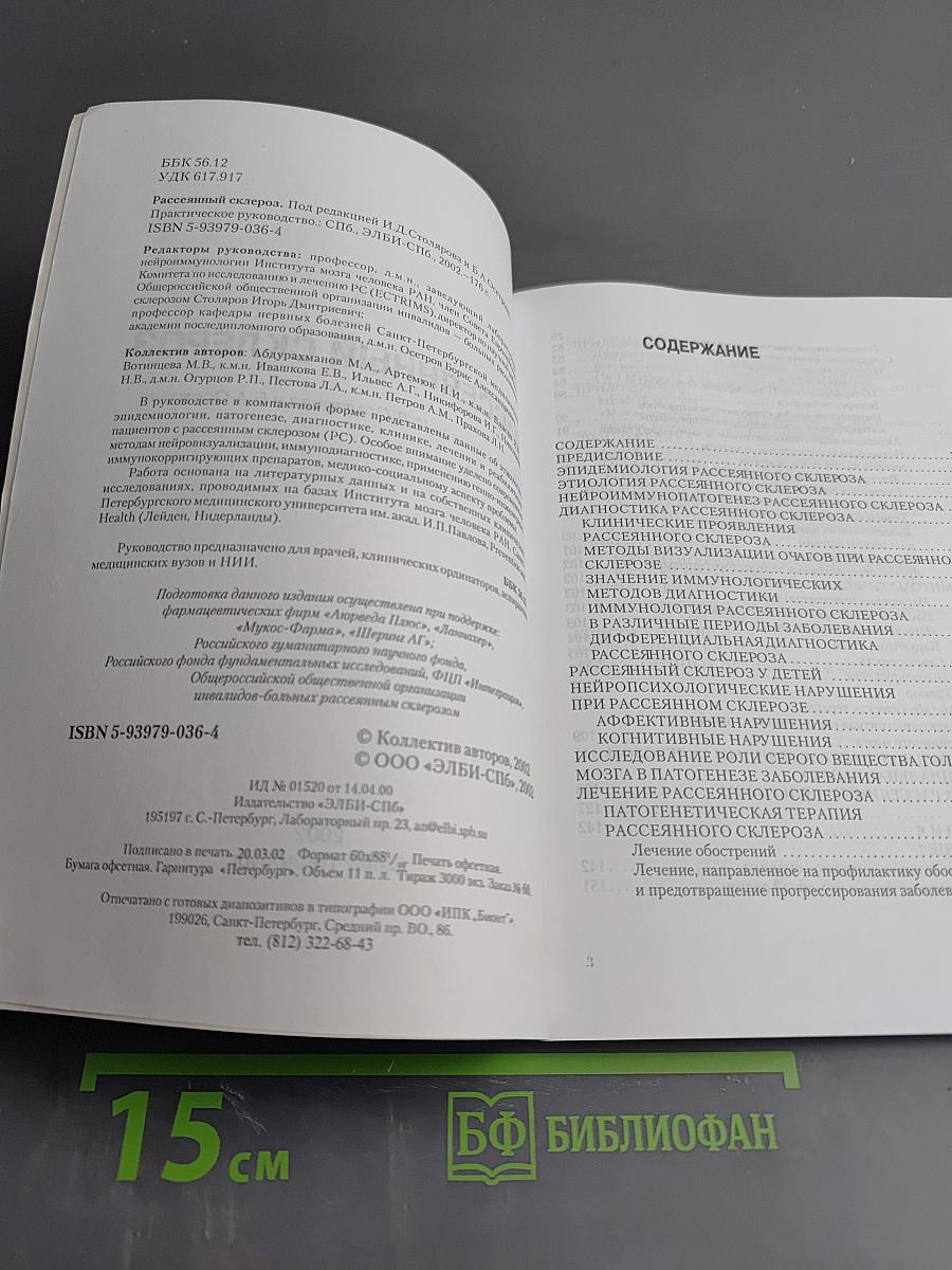 Рассеянный склероз