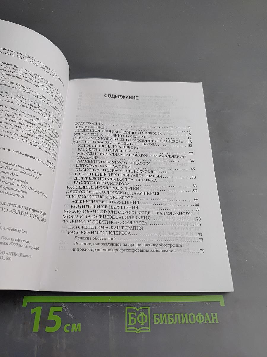 Рассеянный склероз