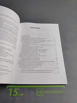 Рассеянный склероз