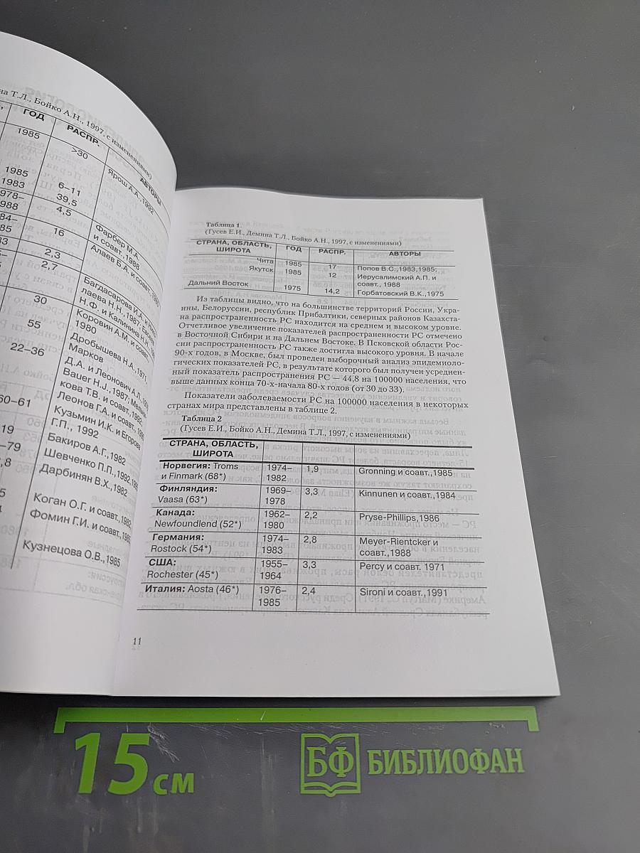 Рассеянный склероз