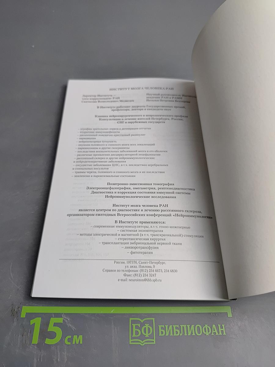 Рассеянный склероз