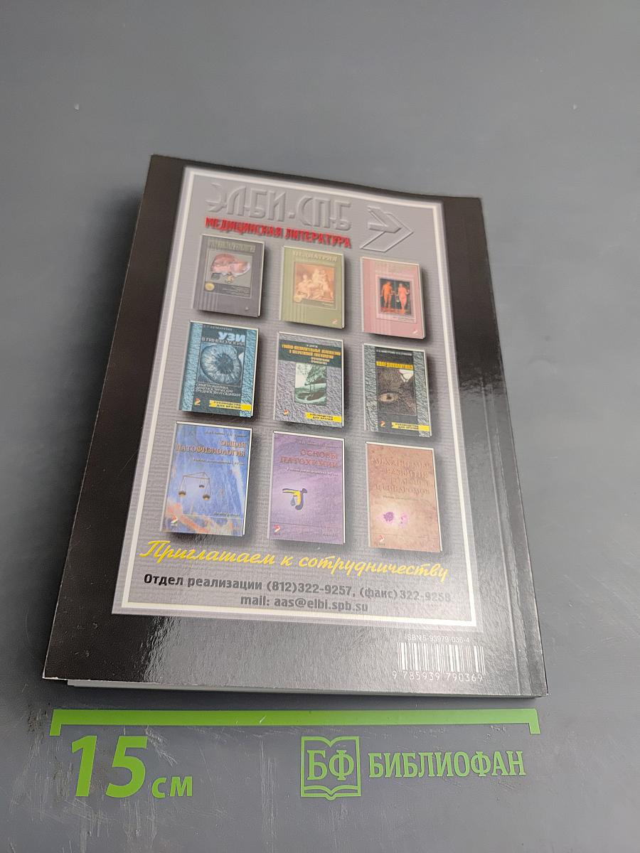 Рассеянный склероз