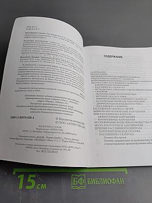 Рассеянный склероз