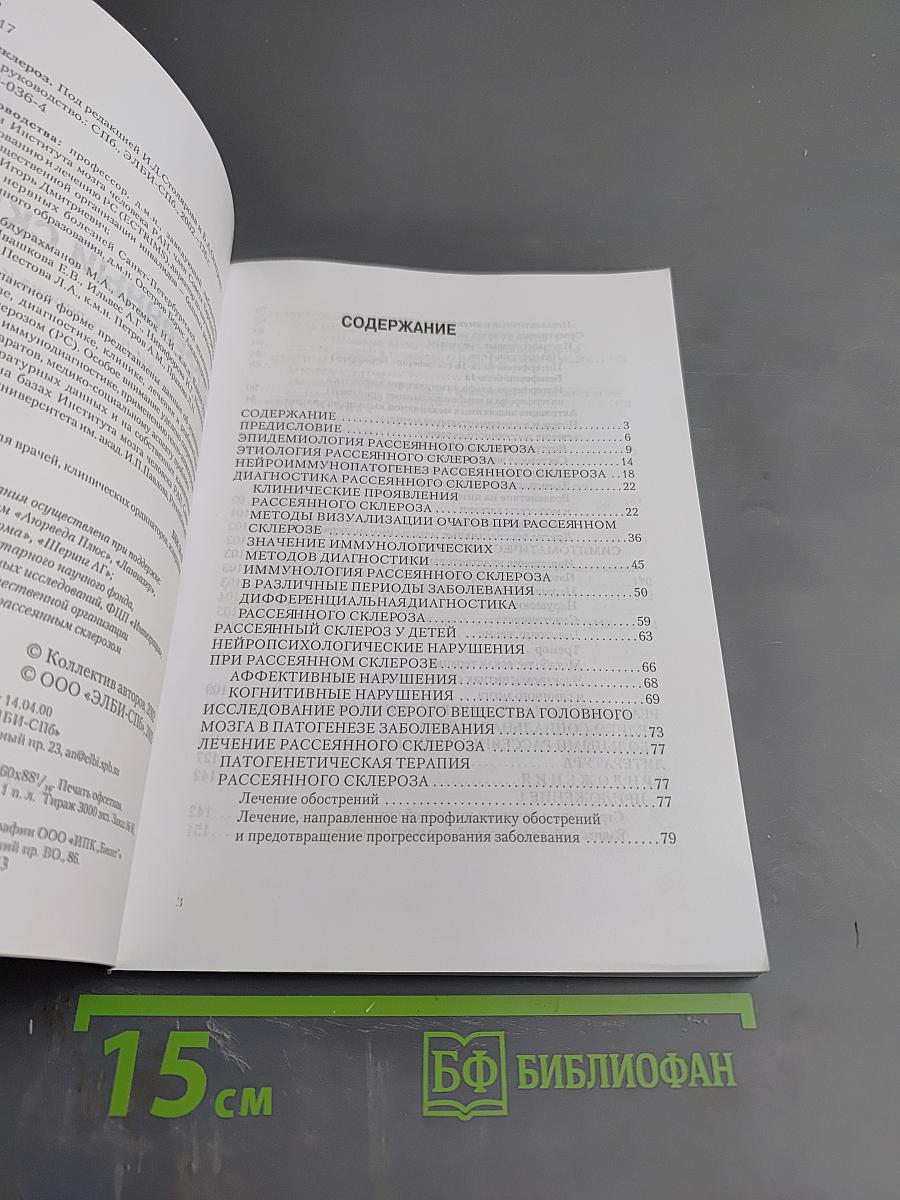 Рассеянный склероз