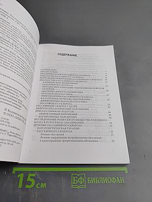 Рассеянный склероз