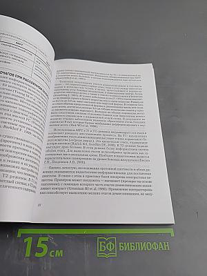 Рассеянный склероз