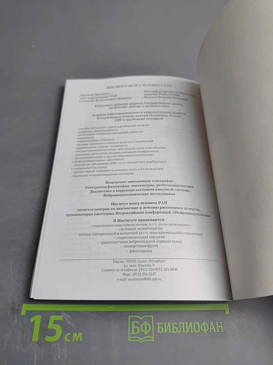 Рассеянный склероз