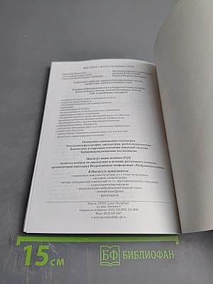 Рассеянный склероз