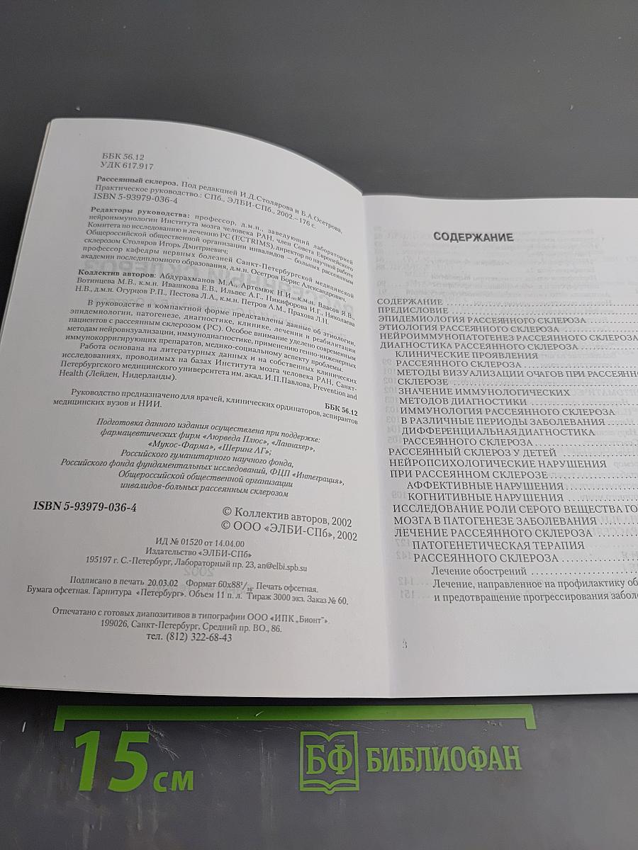 Рассеянный склероз