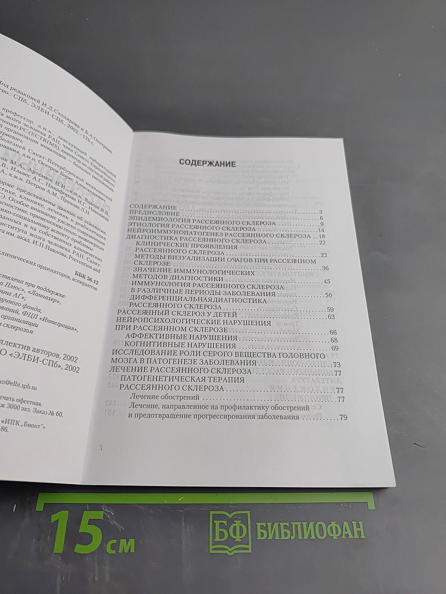 Рассеянный склероз