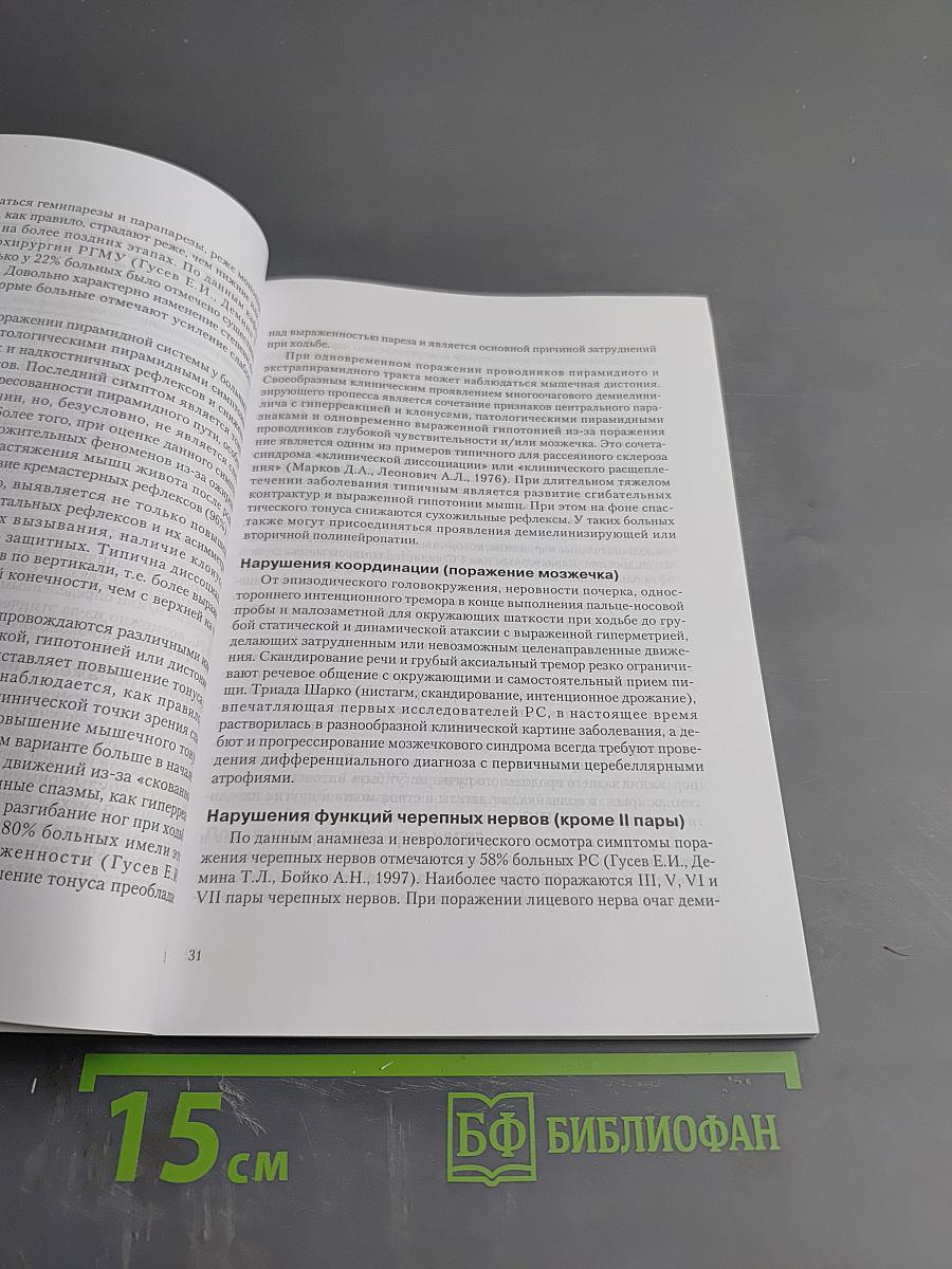 Рассеянный склероз