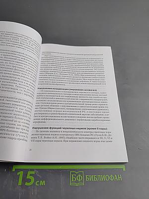 Рассеянный склероз