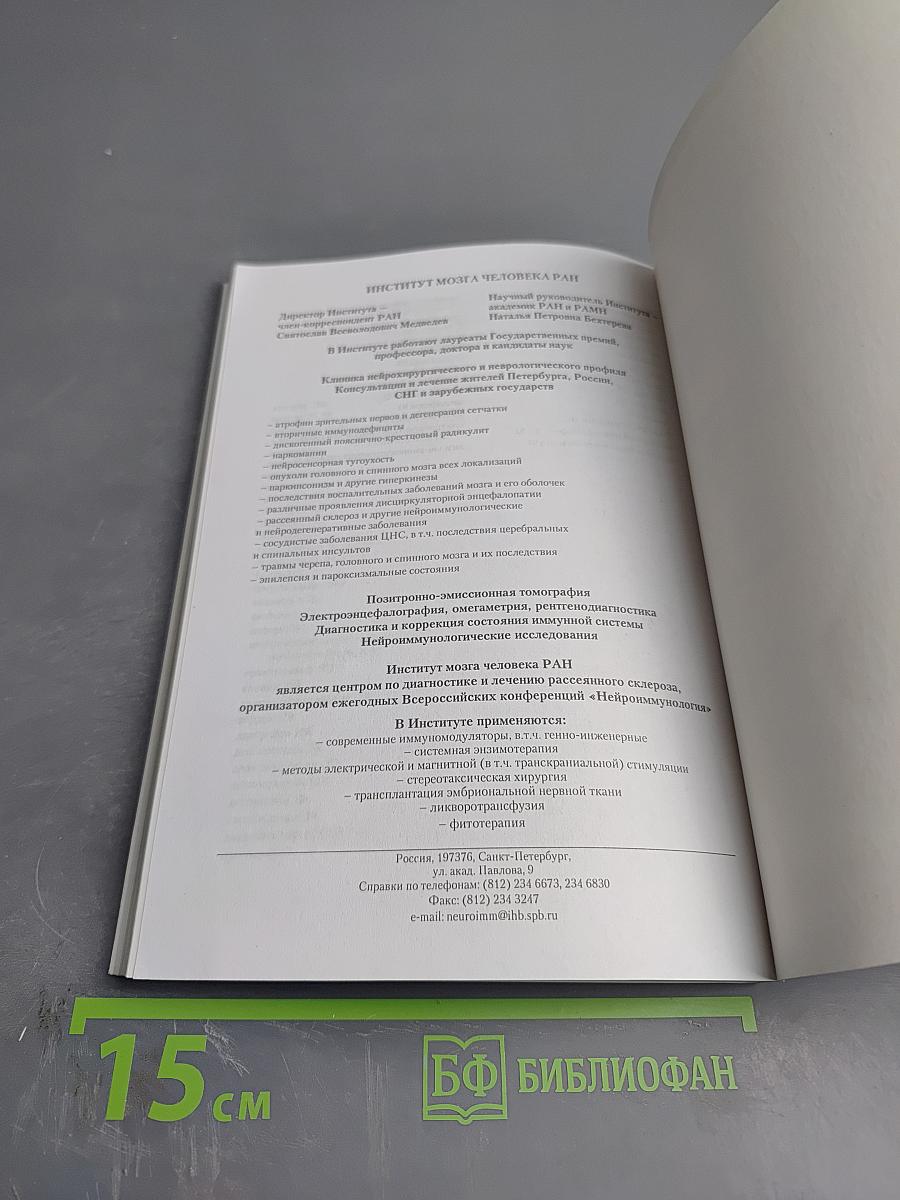 Рассеянный склероз