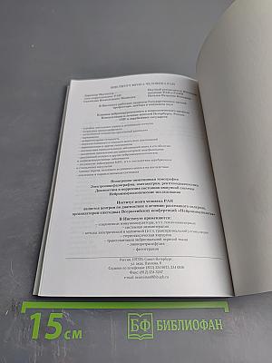 Рассеянный склероз