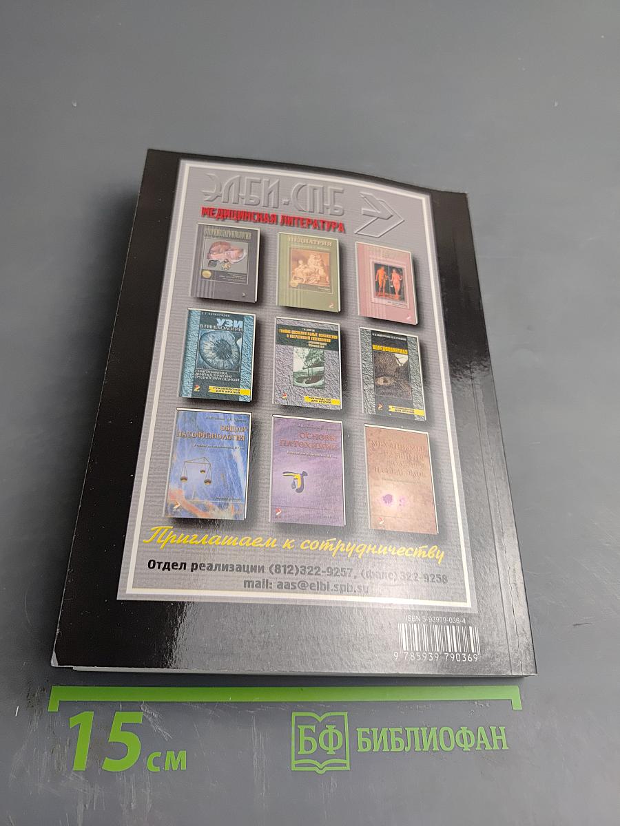 Рассеянный склероз