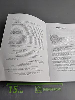 Рассеянный склероз