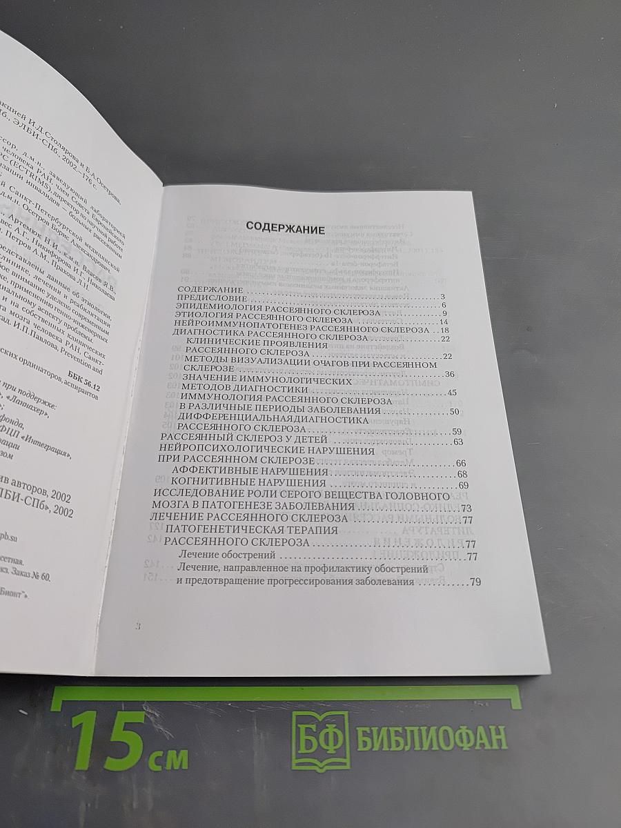 Рассеянный склероз