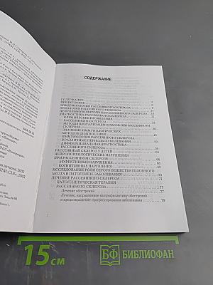 Рассеянный склероз