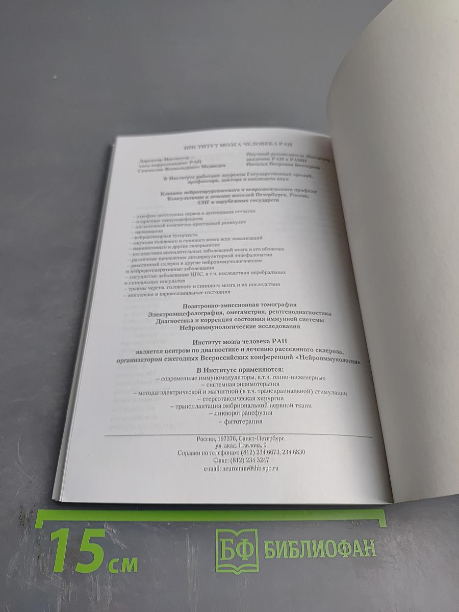 Рассеянный склероз