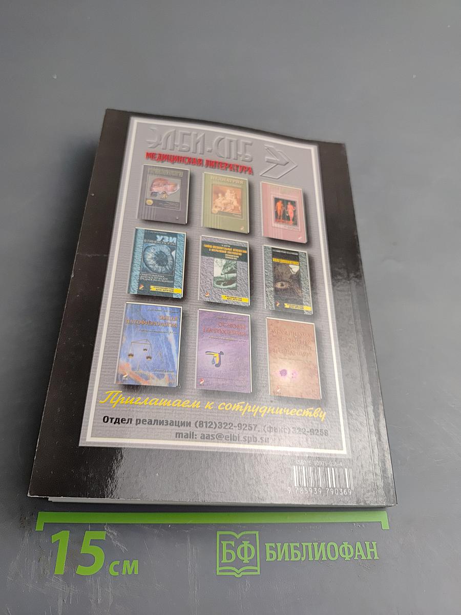 Рассеянный склероз