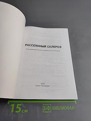 Рассеянный склероз